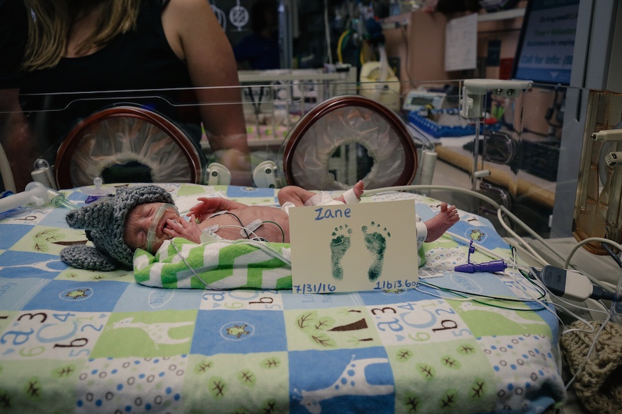  Zane weight just 1 pound 12 ounces when he was born. JoAnn Marrero Photo.  